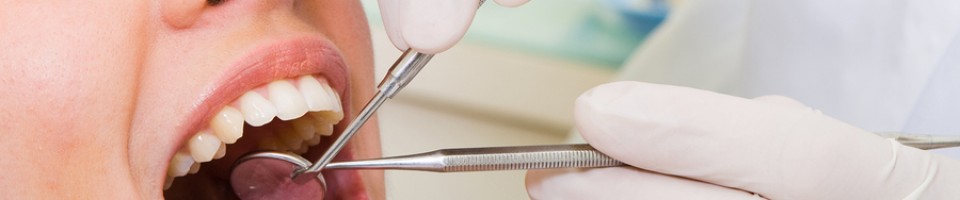 metal free fillings from dentist